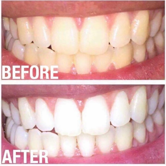 Whitening paste! - Picture 5 of 8